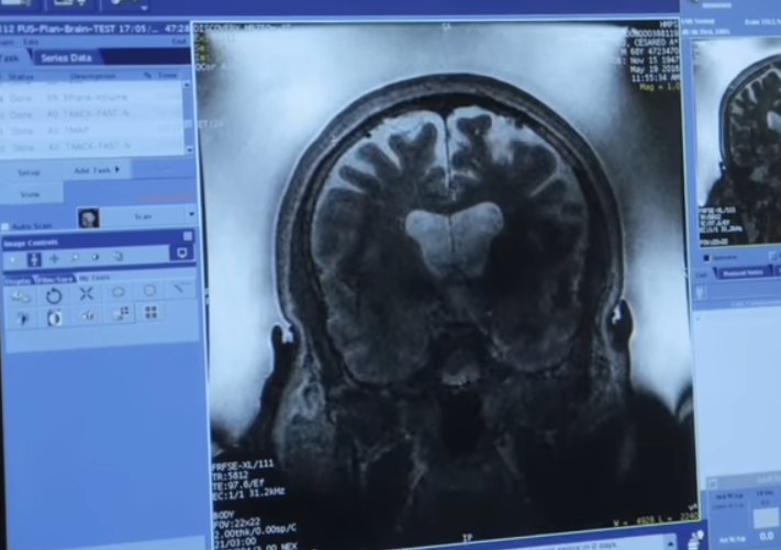 neuroimagen psiquiatría y psicología clínica